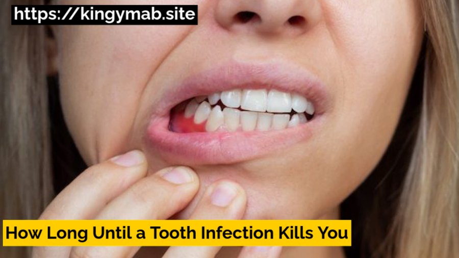 How Long Until a Tooth Infection Kills You